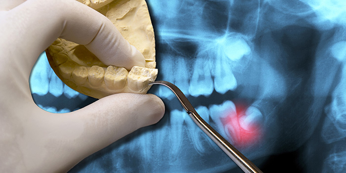 A dentist holding fake teeth while picking at it with a dental tool. An X-ray of a mouth is in the background